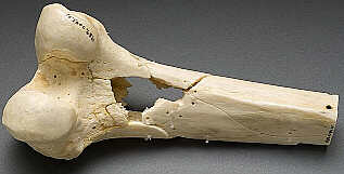 Click image for larger version

Name:	Bone Shattered By A Minie Ball.jpg
Views:	212
Size:	8.2 KB
ID:	231210