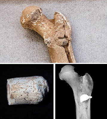 Click image for larger version

Name:	Femur Damaged By Minnie Ball 2nd Manassas.jpg
Views:	57
Size:	106.9 KB
ID:	232519